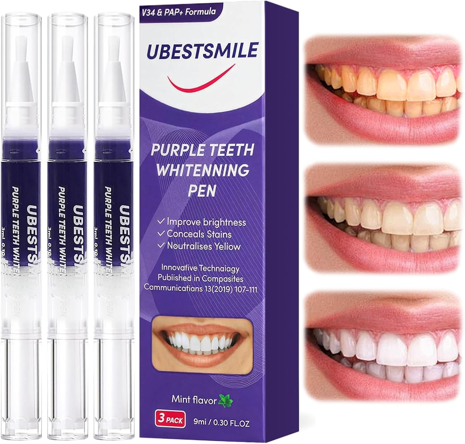 Teeth Whitening Kit - UBESTSMILE V34&PAP+ Formula Purple Teeth Whitening
