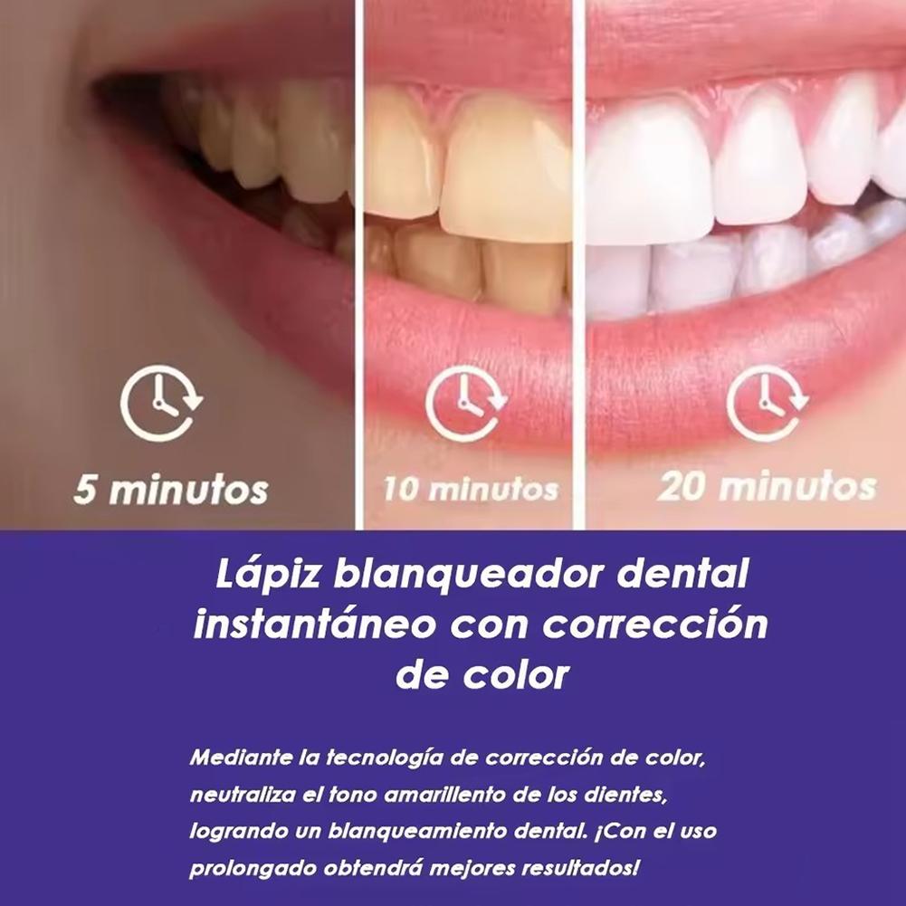 UBESTSMILE V34&PAP+ Formula Pu - Teeth Whitening Kit ulasan dan harga