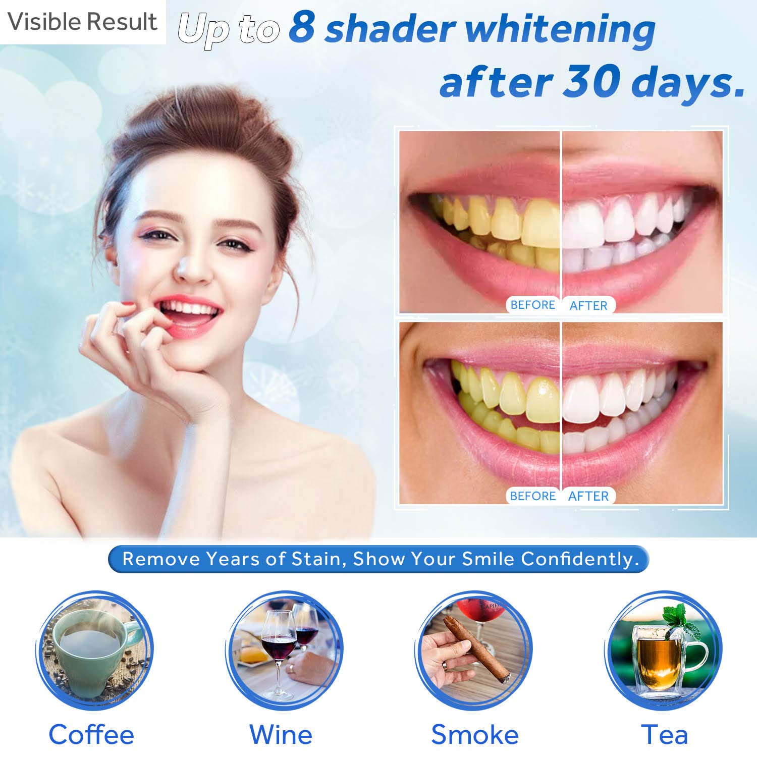 Teeth Whitening Gel Refill Syr - Teeth Whitening Kit ulasan dan harga