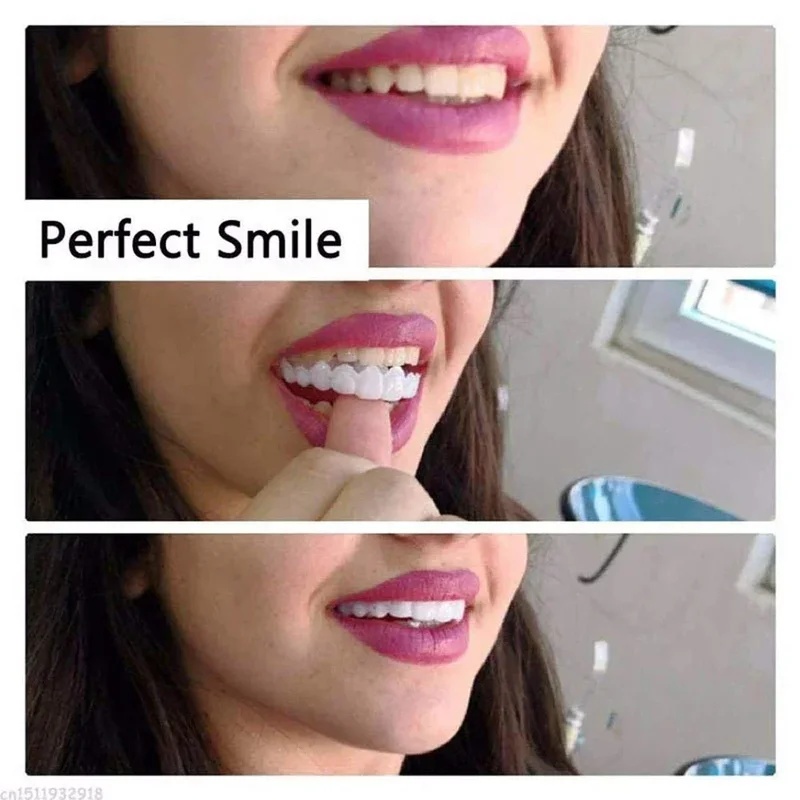 Snap-on Veneer Teeth Kit Adjus - Teeth Whitening Kit ulasan dan harga